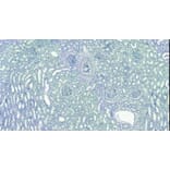 Immunohistochemistry - Anti-EWSR1/EWS Antibody (A83148) - Antibodies.com