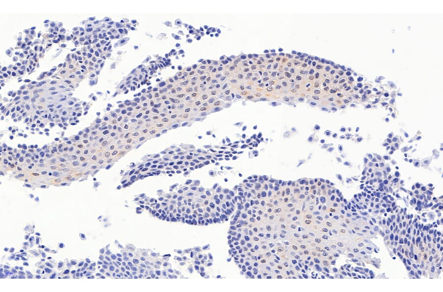 Immunohistochemistry - Anti-PAX3 Antibody (A83151) - Antibodies.com