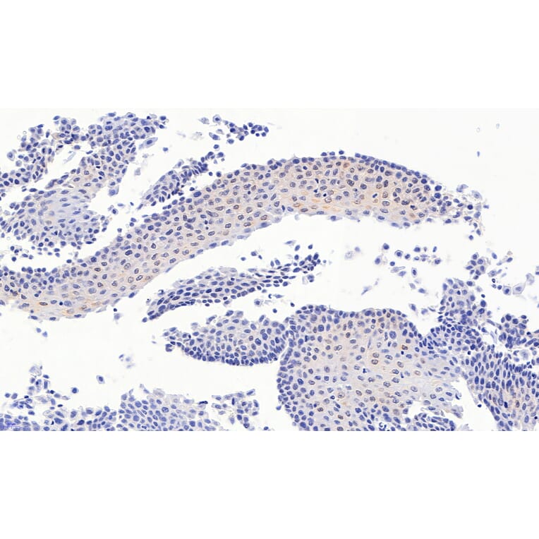 Immunohistochemistry - Anti-PAX3 Antibody (A83151) - Antibodies.com