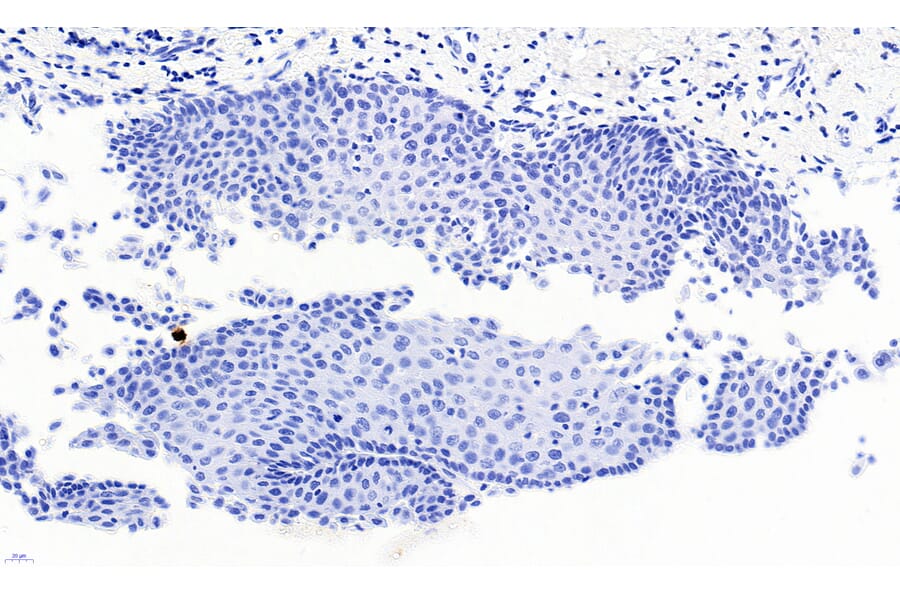 Immunohistochemistry - Anti-PAX3 Antibody (A83151) - Antibodies.com