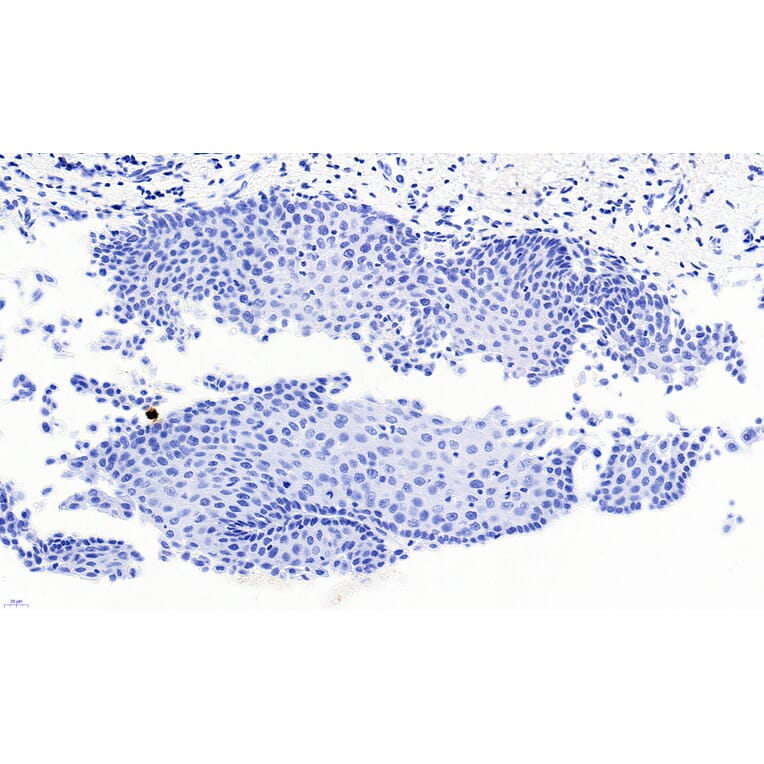 Immunohistochemistry - Anti-PAX3 Antibody (A83151) - Antibodies.com
