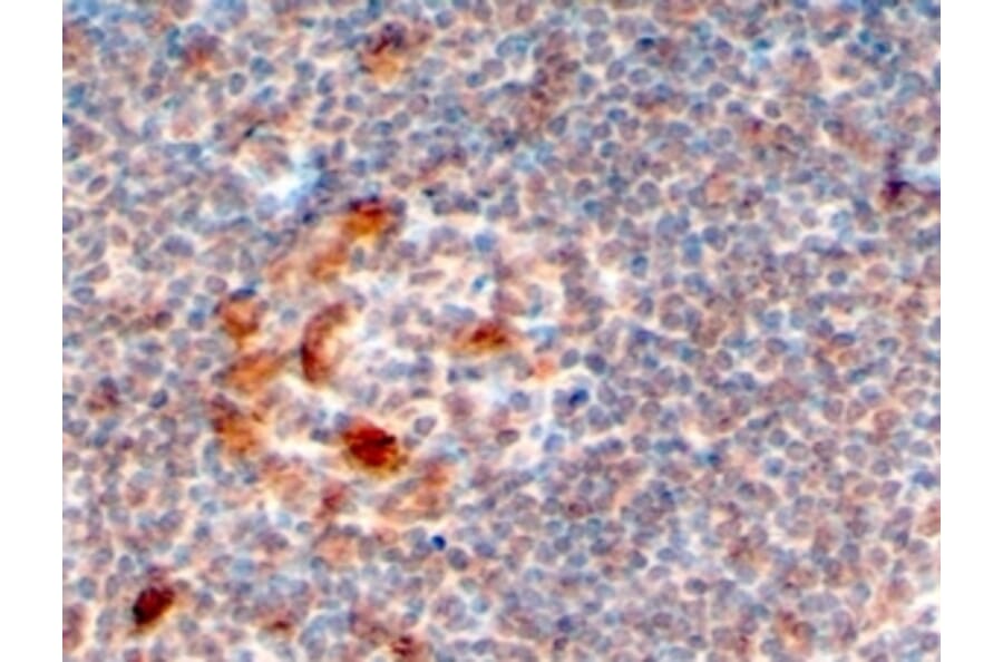 Immunohistochemistry - Anti-ZCCHC11 Antibody (A83152) - Antibodies.com
