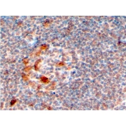 Immunohistochemistry - Anti-ZCCHC11 Antibody (A83152) - Antibodies.com