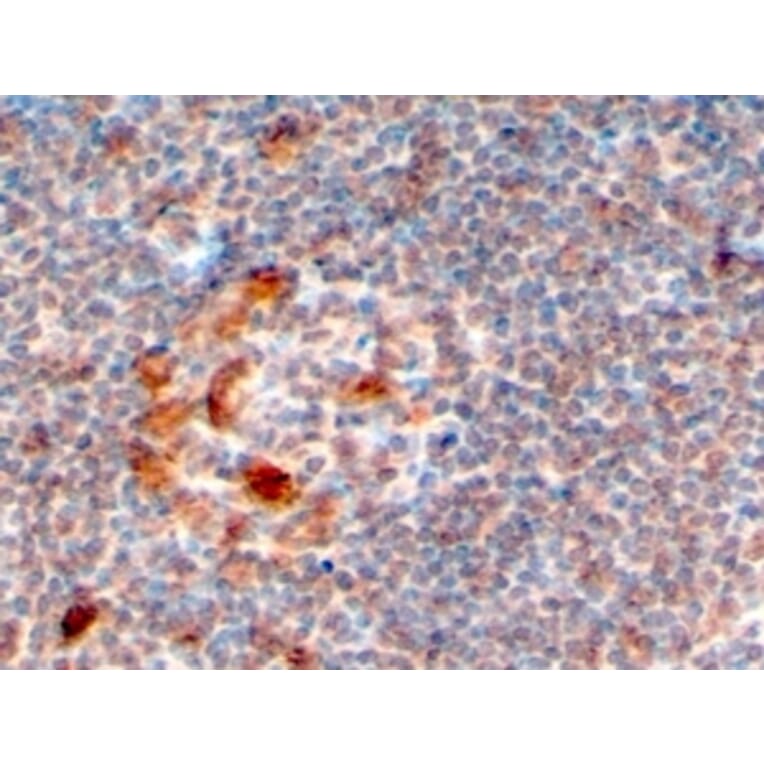 Immunohistochemistry - Anti-ZCCHC11 Antibody (A83152) - Antibodies.com