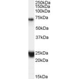 Western Blot - Anti-Huntingtin Associated Protein 1 Antibody (A83153) - Antibodies.com