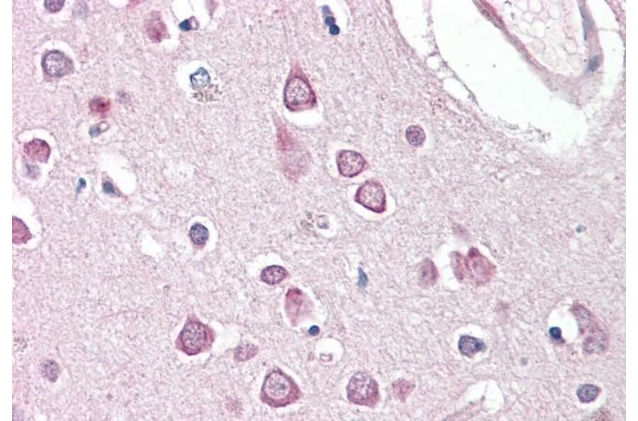 Immunohistochemistry - Anti-Huntingtin Associated Protein 1 Antibody (A83153) - Antibodies.com