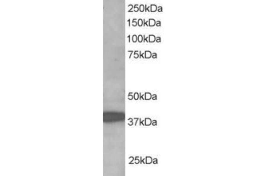 Western Blot - Anti-RNF39 Antibody (A83154) - Antibodies.com