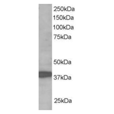 Western Blot - Anti-RNF39 Antibody (A83154) - Antibodies.com