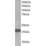 Western Blot - Anti-RNF39 Antibody (A83154) - Antibodies.com