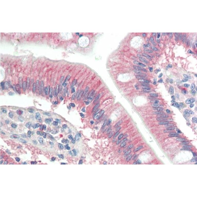 Immunohistochemistry - Anti-RNF39 Antibody (A83154) - Antibodies.com