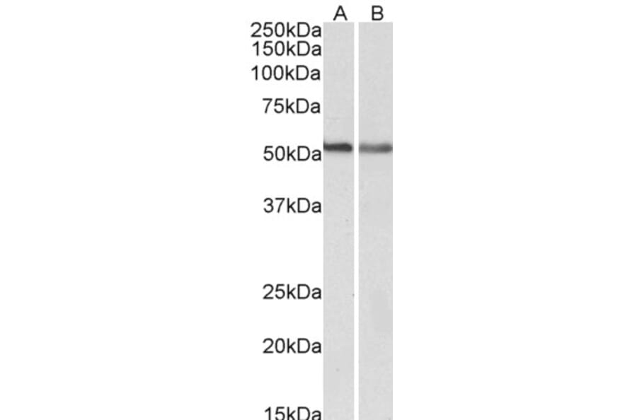 Western Blot - Anti-Cannabinoid Receptor I Antibody (A83155) - Antibodies.com