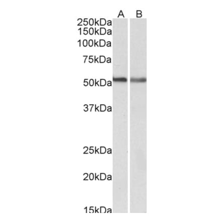 Western Blot - Anti-Cannabinoid Receptor I Antibody (A83155) - Antibodies.com