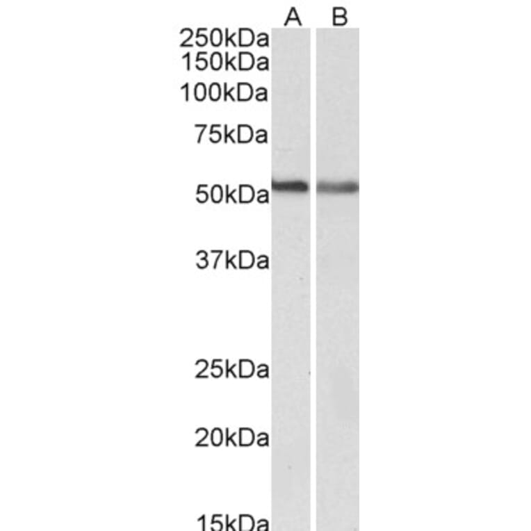 Western Blot - Anti-Cannabinoid Receptor I Antibody (A83155) - Antibodies.com