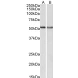 Western Blot - Anti-Cannabinoid Receptor I Antibody (A83155) - Antibodies.com