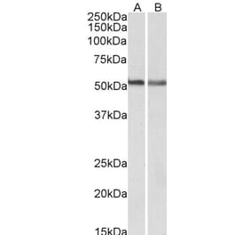 Western Blot - Anti-CNR1 Antibody (A83155) - Antibodies.com