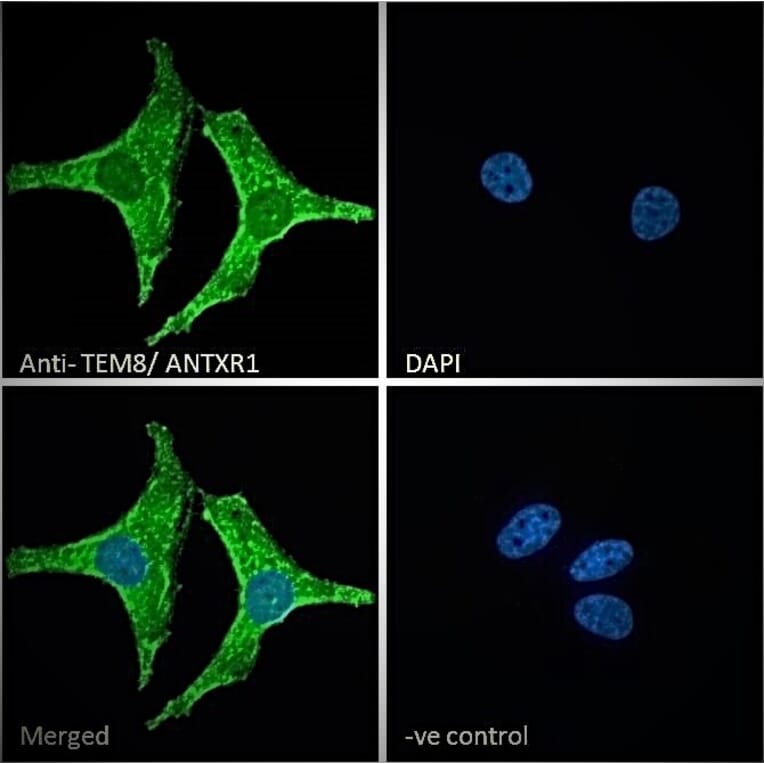 Immunofluorescence - Anti-TEM8 Antibody (A83157) - Antibodies.com