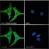 Immunofluorescence - Anti-TEM8 Antibody (A83157) - Antibodies.com