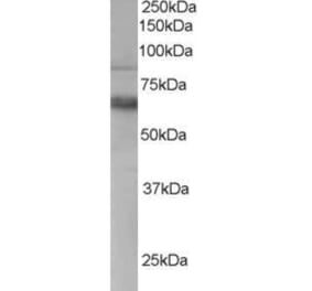 Western Blot - Anti-ANTXR1 Antibody (A83157) - Antibodies.com
