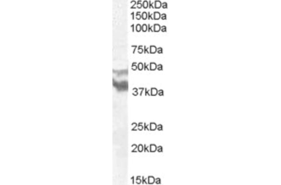 Western Blot - Anti-DYX1C1 Antibody (A83158) - Antibodies.com