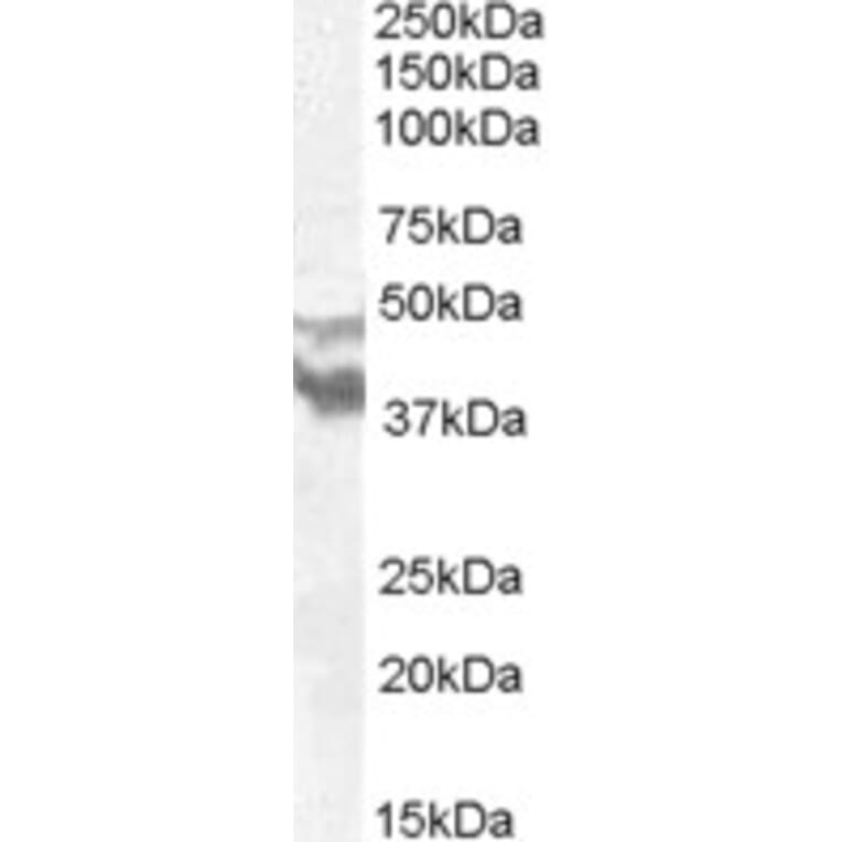 Western Blot - Anti-DYX1C1 Antibody (A83158) - Antibodies.com