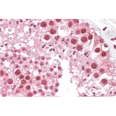 Immunohistochemistry - Anti-MSH5 Antibody (A83159) - Antibodies.com