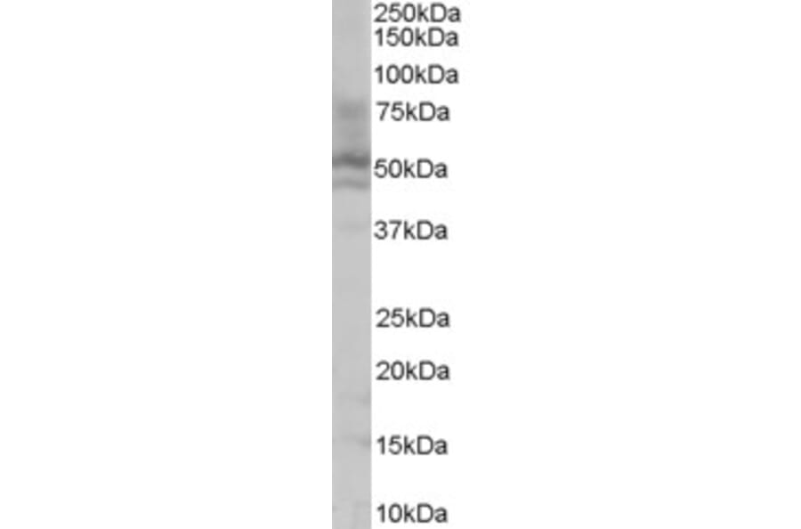 Western Blot - Anti-HNF-4-alpha Antibody (A83160) - Antibodies.com