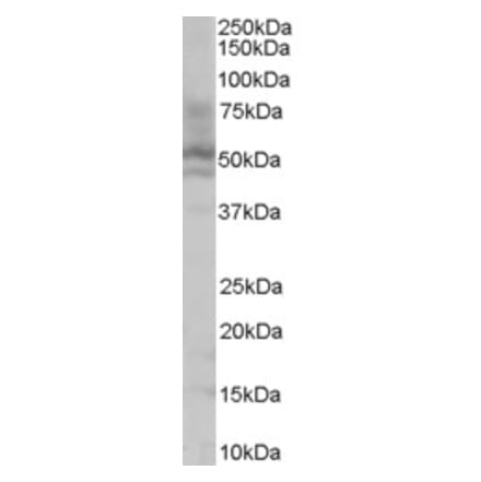 Western Blot - Anti-HNF-4-alpha Antibody (A83160) - Antibodies.com