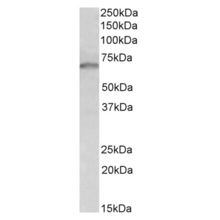 Western Blot - Anti-GRB10 Antibody (A83162) - Antibodies.com