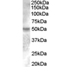 Western Blot - Anti-Estrogen Related Receptor gamma Antibody (A83163) - Antibodies.com