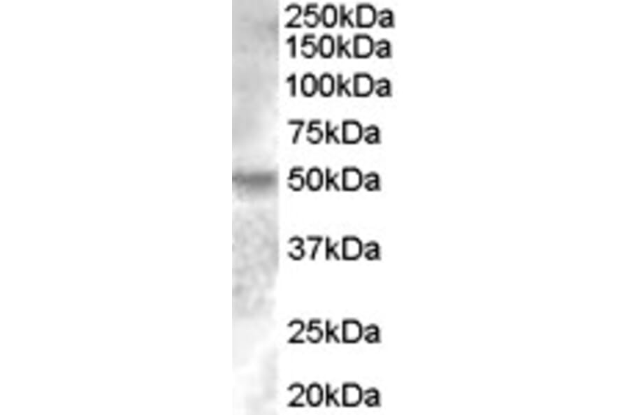 Western Blot - Anti-Estrogen Related Receptor gamma Antibody (A83163) - Antibodies.com