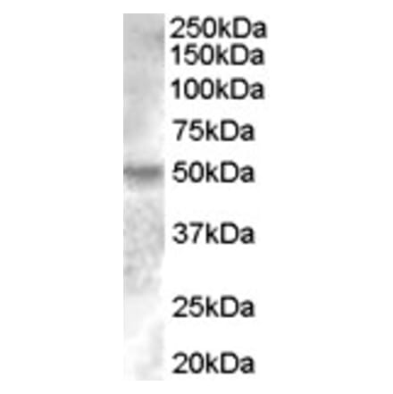 Western Blot - Anti-Estrogen Related Receptor gamma Antibody (A83163) - Antibodies.com