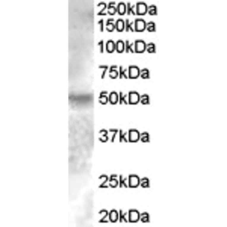Western Blot - Anti-Estrogen Related Receptor gamma Antibody (A83163) - Antibodies.com