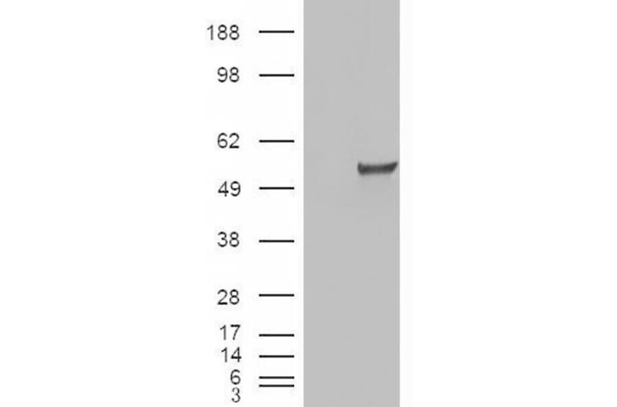 Western Blot - Anti-Estrogen Related Receptor gamma Antibody (A83163) - Antibodies.com