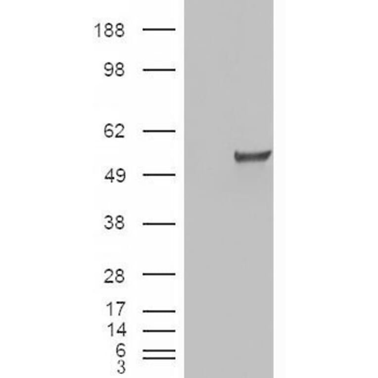 Western Blot - Anti-Estrogen Related Receptor gamma Antibody (A83163) - Antibodies.com