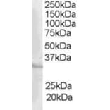 Western Blot - Anti-ICER Antibody (A83164) - Antibodies.com