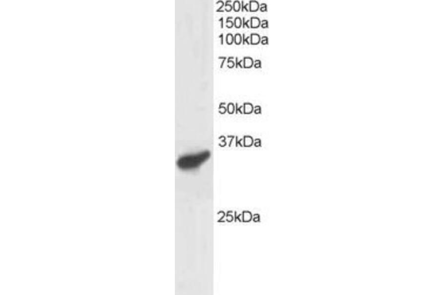 Western Blot - Anti-PCGF3 Antibody (A83167) - Antibodies.com
