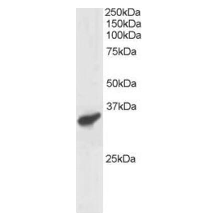 Western Blot - Anti-PCGF3 Antibody (A83167) - Antibodies.com