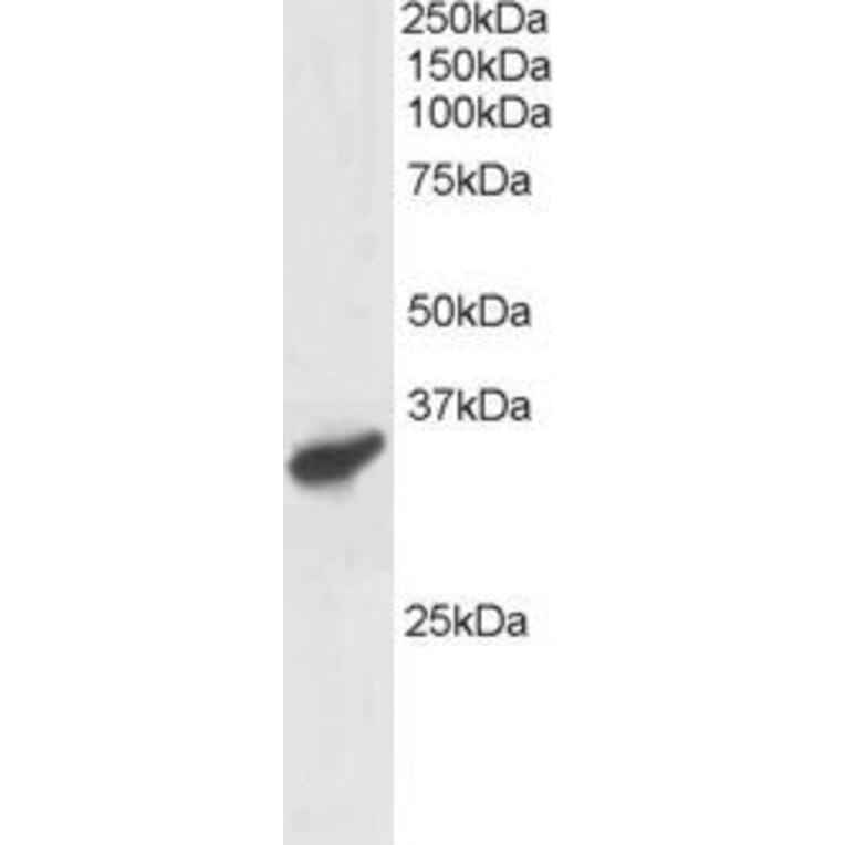 Western Blot - Anti-PCGF3 Antibody (A83167) - Antibodies.com