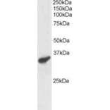 Western Blot - Anti-PCGF3 Antibody (A83167) - Antibodies.com