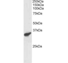 Western Blot - Anti-PCGF3 Antibody (A83167) - Antibodies.com