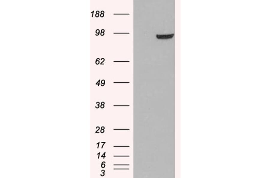 Western Blot - Anti-PDE5A/PDE5 Antibody (A83168) - Antibodies.com