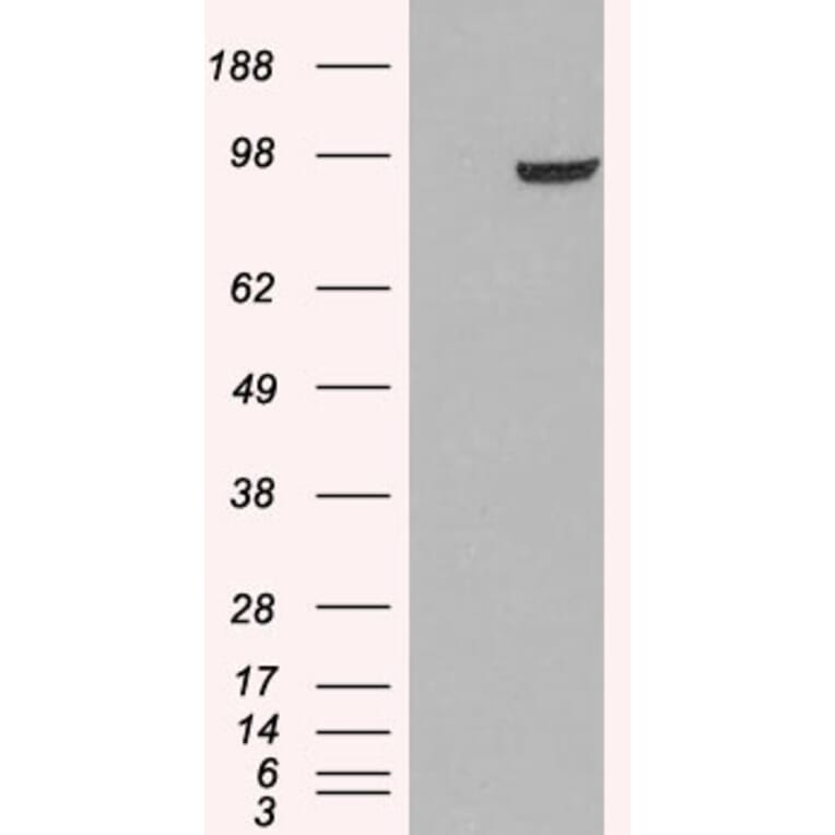 Western Blot - Anti-PDE5A/PDE5 Antibody (A83168) - Antibodies.com