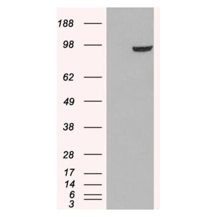 Western Blot - Anti-PDE5A Antibody (A83168)