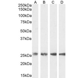 Western Blot - Anti-Triosephosphate Isomerase Antibody (A83170) - Antibodies.com