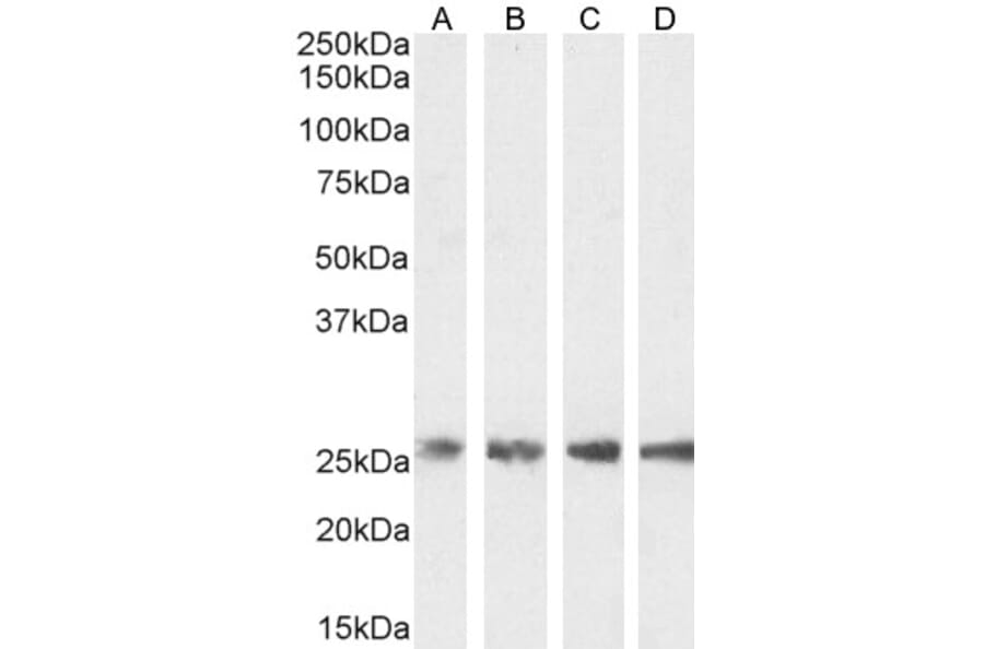 Western Blot - Anti-Triosephosphate Isomerase Antibody (A83170) - Antibodies.com
