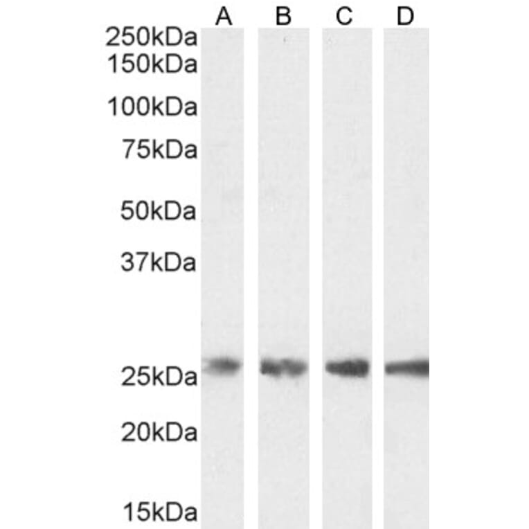 Western Blot - Anti-Triosephosphate Isomerase Antibody (A83170) - Antibodies.com