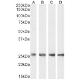 Western Blot - Anti-Triosephosphate Isomerase Antibody (A83170) - Antibodies.com