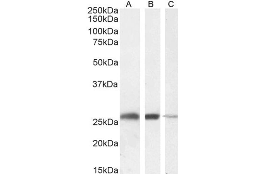 Western Blot - Anti-Triosephosphate Isomerase Antibody (A83170) - Antibodies.com