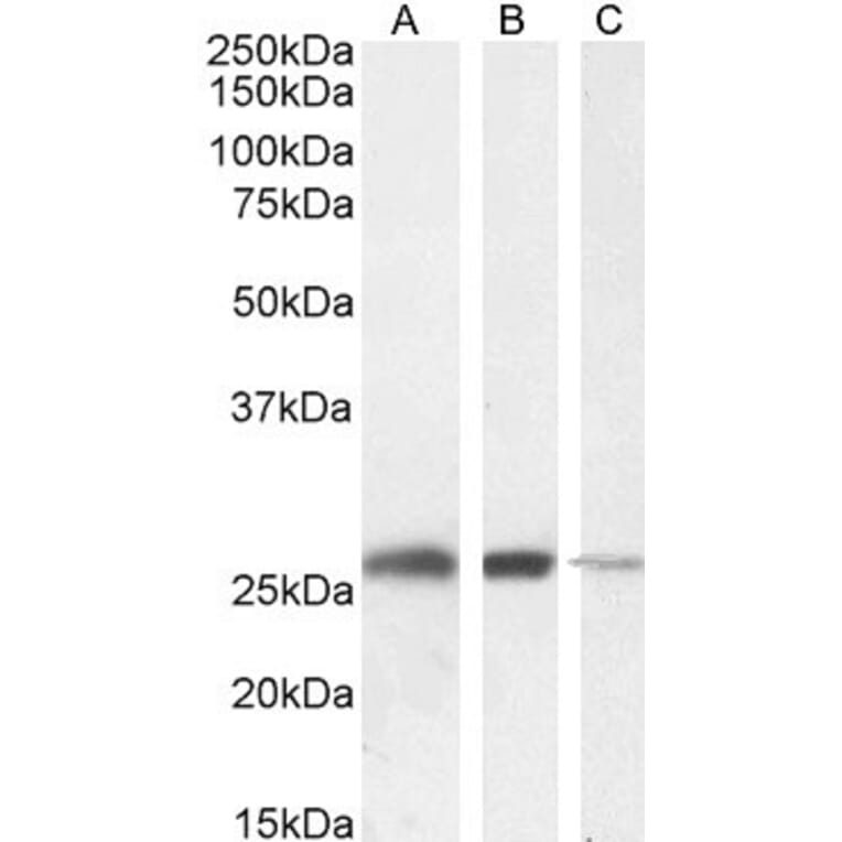 Western Blot - Anti-Triosephosphate Isomerase Antibody (A83170) - Antibodies.com