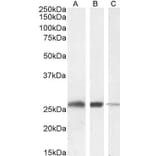 Western Blot - Anti-Triosephosphate Isomerase Antibody (A83170) - Antibodies.com